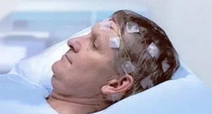 腦氧監(jiān)測在圍術(shù)期的應(yīng)用