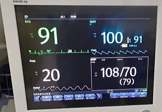 SpO2監(jiān)測不僅有數(shù)值，還有波形(圖2)