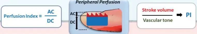 SpO2監(jiān)測不僅有數(shù)值，還有波形(圖1)
